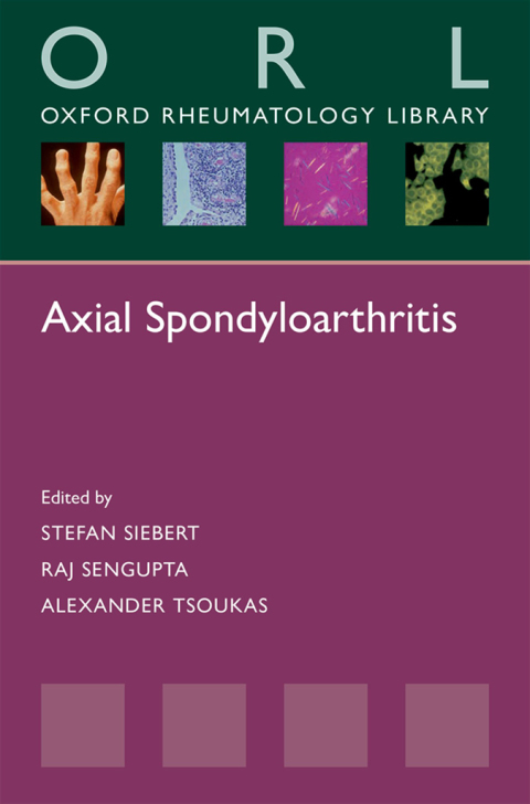 Book Axial Spondyloarthritis (Oxford Rheumatology Library) free