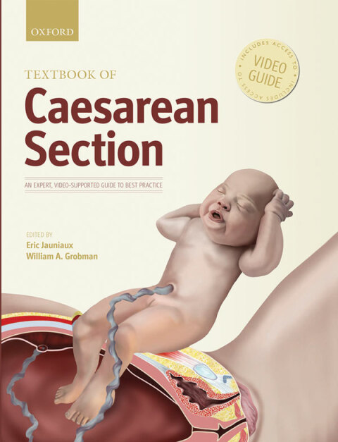Book Textbook of Caesarean Section free
