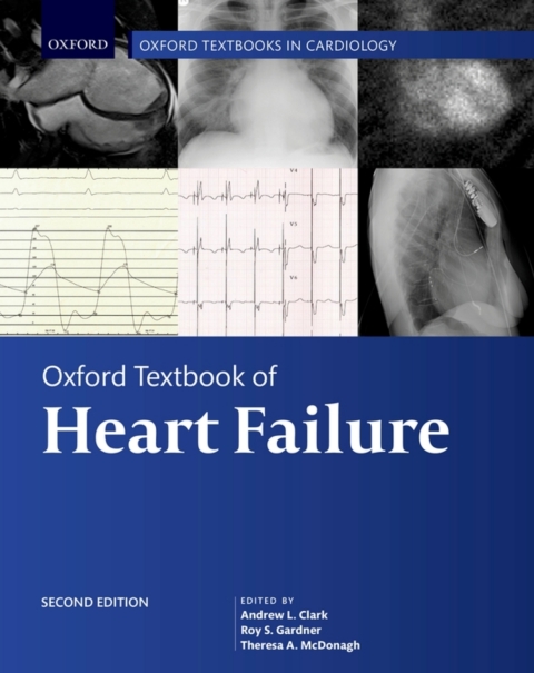 Book Oxford Textbook of Heart Failure free
