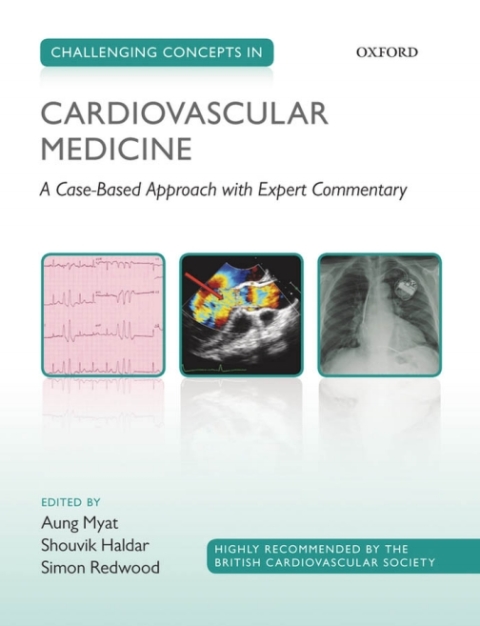 Book Challenging Concepts in Cardiovascular Medicine free