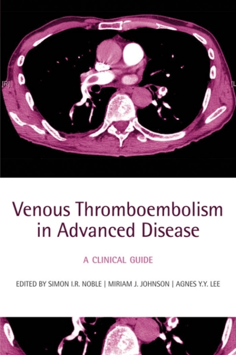Book Venous Thromboembolism in Advanced Disease free