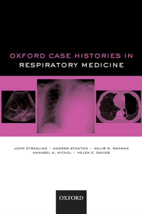 Book Oxford Case Histories in Respiratory Medicine free