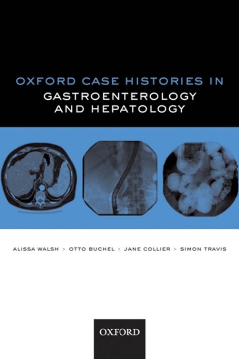 Book Oxford Case Histories in Gastroenterology and Hepatology free