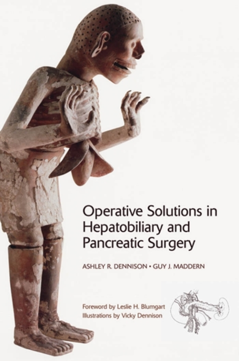 Book Operative Solutions in Hepatobiliary and Pancreatic Surgery free