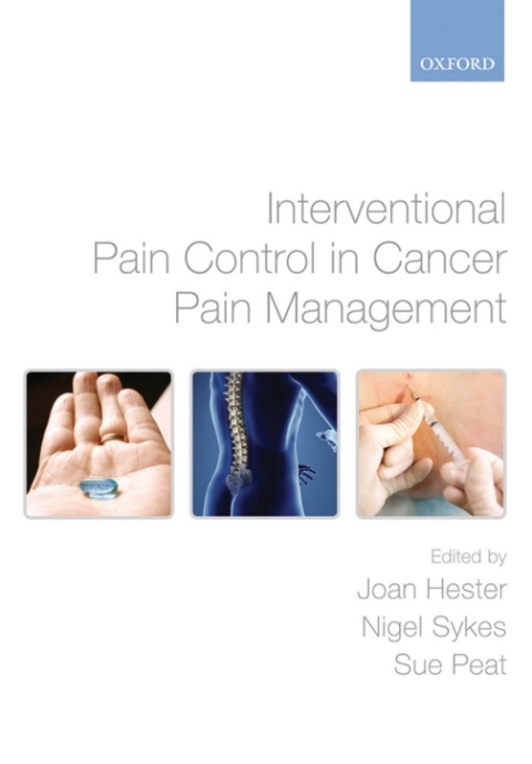 Book Interventional Pain Control in Cancer Pain Management free