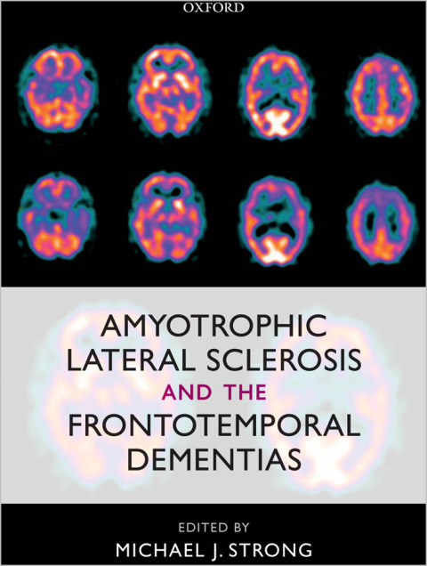 Book Amyotrophic Lateral Sclerosis and the Frontotemporal Dementias free