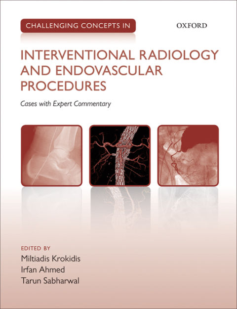 Book Challenging Concepts in Interventional Radiology (Challenging Cases) free