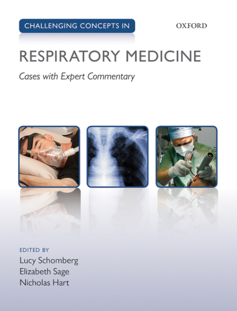 Book Challenging Concepts in Respiratory Medicine: Cases with Expert Commentary (Challenging Cases) free