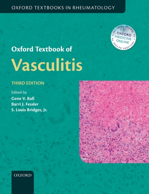 Book Oxford Textbook of Vasculitis free
