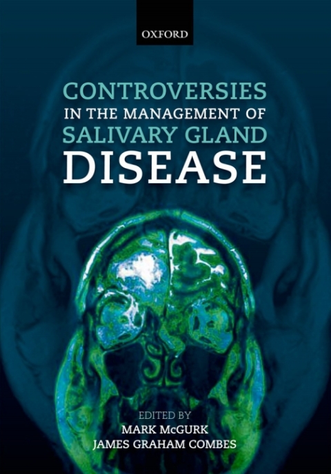 Book Controversies in the Management of Salivary Gland Disease free