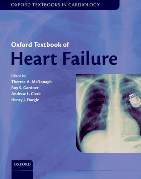 Book Oxford Textbook of Heart Failure free