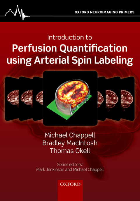 Book Introduction to Perfusion Quantification using Arterial Spin Labelling free