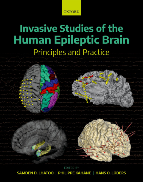 Book Invasive Studies of the Human Epileptic Brain: Principles and Practice free
