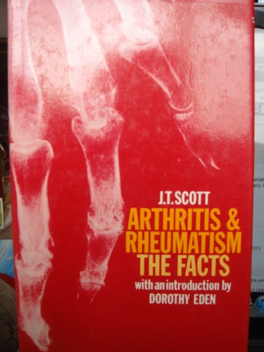 Book Arthritis and Rheumatism: The Facts (The Facts Series) free