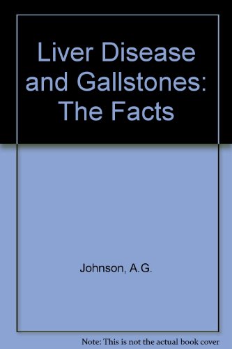 Book Liver Disease and Gallstones: The Facts (The Facts Series) free