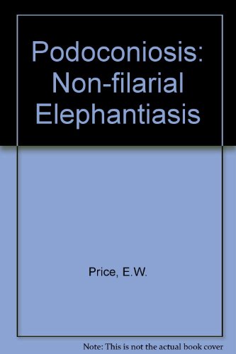 Book Podoconiosis: Non-filarial Elephantiasis (oxford Medical Publications) free