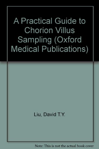 Book A Practical Guide To Chorion Villus Sampling free