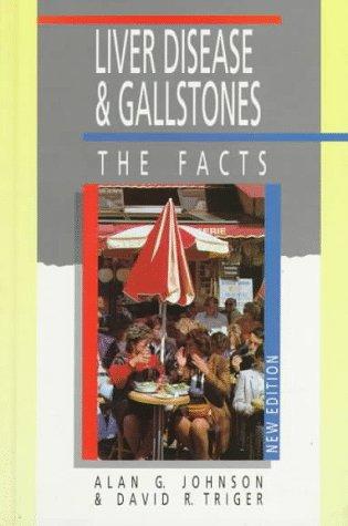 Book Liver Disease and Gallstones: The Facts (The Facts Series) free