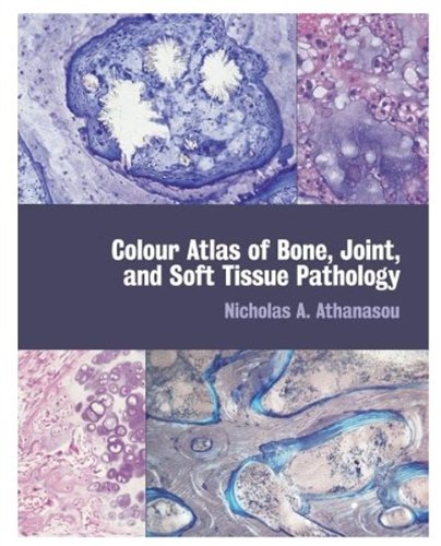 Book Colour Atlas of Bone, Joint, and Soft Tissue Pathology free