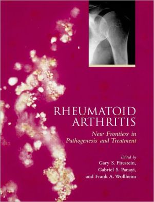 Book Rheumatoid Arthritis: Frontiers in Pathogenesis and Treatment free