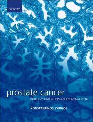 Book Prostate Cancer: Biology, Diagnosis and Management (Oxford Medical Publications) free