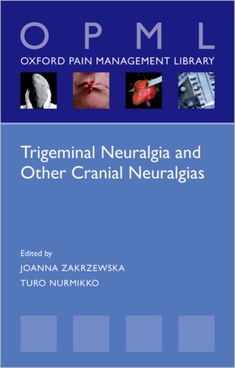 Book Trigeminal Neuralgia and Other Cranial Neuralgias free