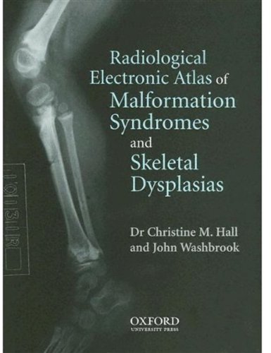 Book Radiological Atlas Of Malformation Syndromes And Skeletal Dysplasias: Windows Cd-rom Single User Version free