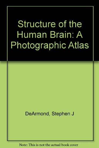 Book Structure of the human brain;: A photographic atlas free