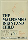 Book The Malformed Infant And Child: An Illustrated Guide free