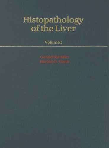 Book Histopathology of the Liver: 2 Volume Set free