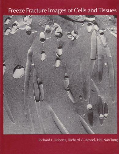 Book Freeze Fracture Images Of Cells And Tissues free