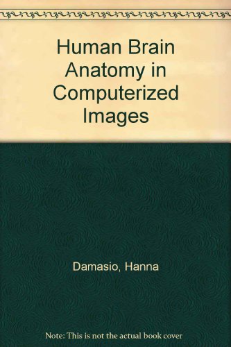 Book Human Brain Anatomy in Computerized Images free