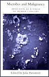 Book Microbes and Malignancy: Infection as a Cause of Human Cancers free