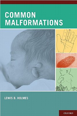 Book Common Malformations free