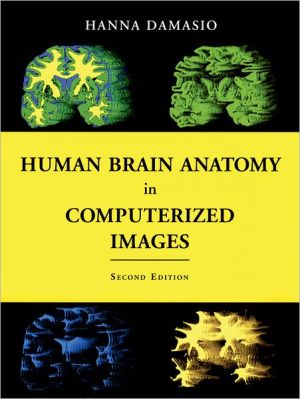 Book Human Brain Anatomy in Computerized Images free