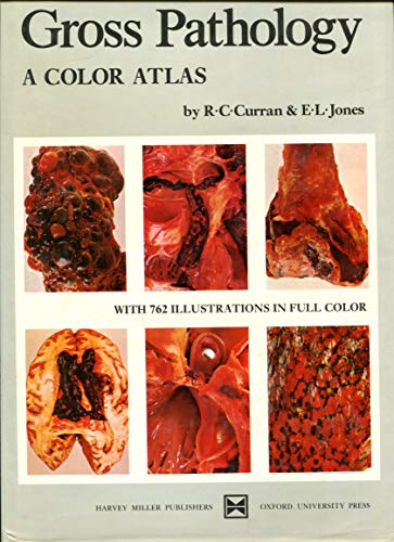 Book Gross Pathology: A Color Atlas free