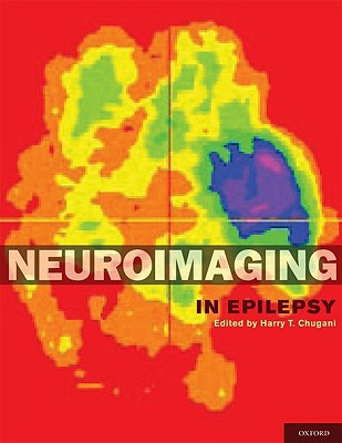 Book Neuroimaging in Epilepsy free