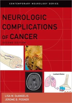 Book Neurologic Complications of Cancer (Contemporary Neurology Series, 73) free