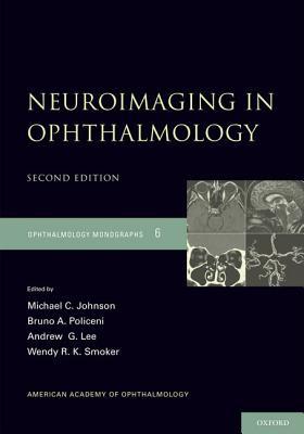 Book Neuroimaging in Ophthalmology (American Academy of Ophthalmology Monograph Series) free