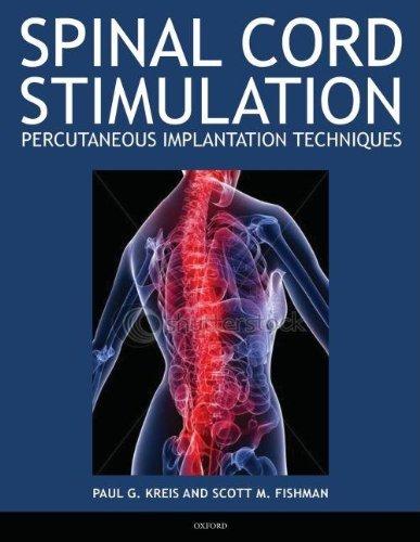 Book Spinal Cord Stimulation: Percutaneous Implantation Techniques free