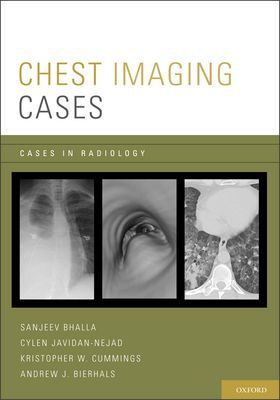 Book Chest Imaging Cases (Cases in Radiology) free