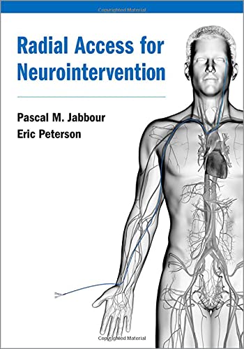 Book Radial Access for Neurointervention free