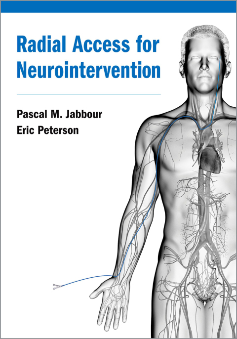 Book Radial Access for Neurointervention free