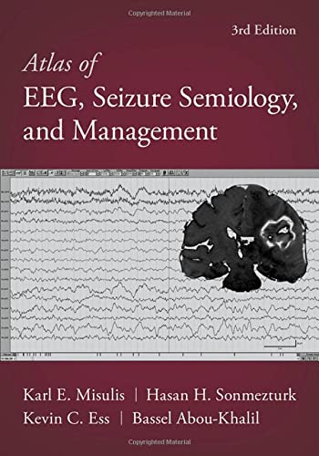 Book Atlas of EEG, Seizure Semiology, and Management free