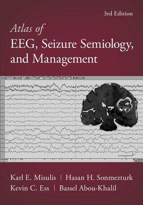 Book Atlas of EEG, Seizure Semiology, and Management free