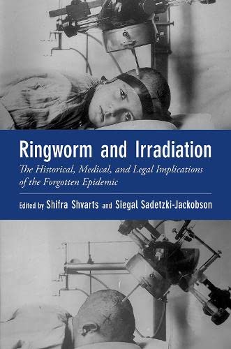 Book Ringworm and Irradiation: The Historical, Medical, and Legal Implications of the Forgotten Epidemic (Oxford Medical Online) free