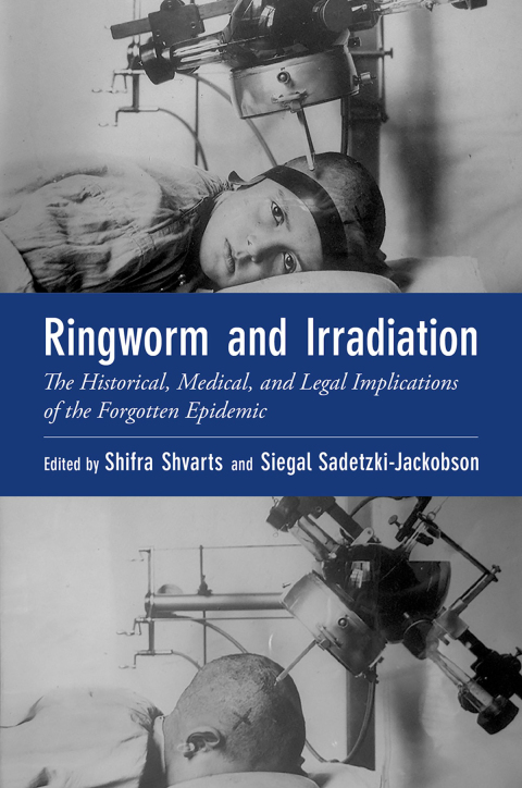 Book Ringworm and Irradiation: The Historical, Medical, and Legal Implications of the Forgotten Epidemic (Oxford Medical Online) free