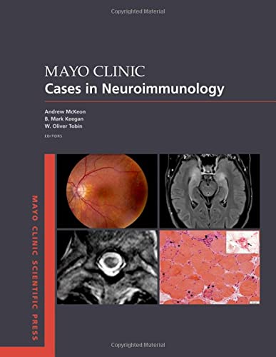 Book Mayo Clinic Cases in Neuroimmunology (Mayo Clinic Scientific Press) free