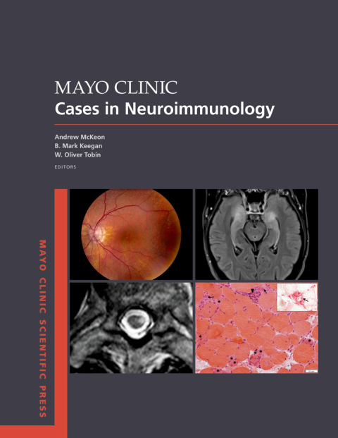 Book Mayo Clinic Cases in Neuroimmunology (Mayo Clinic Scientific Press) free