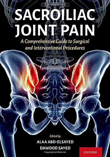 Book Sacroiliac Joint Pain: A Comprehensive Guide to Interventional and Surgical Procedures free